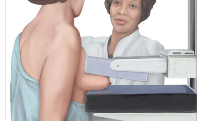 mammografiia
